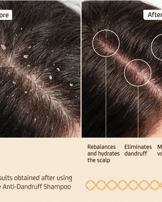 Натурален шампоан против пърхот NuggelaSule Epigenetic Shampoo Anti-Dandruff 250ml