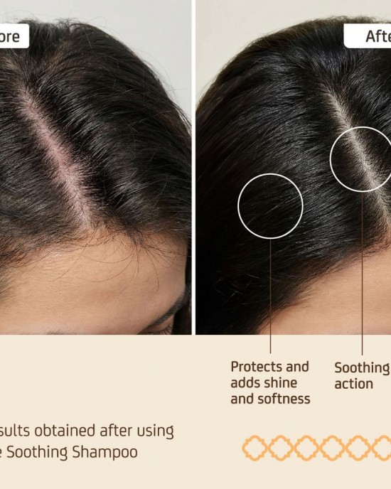 Натурален успокояващ шампоан за чувствителен скалп и дерматит NuggelaSule Epigenetic Shampoo Sensitive Skin 250ml